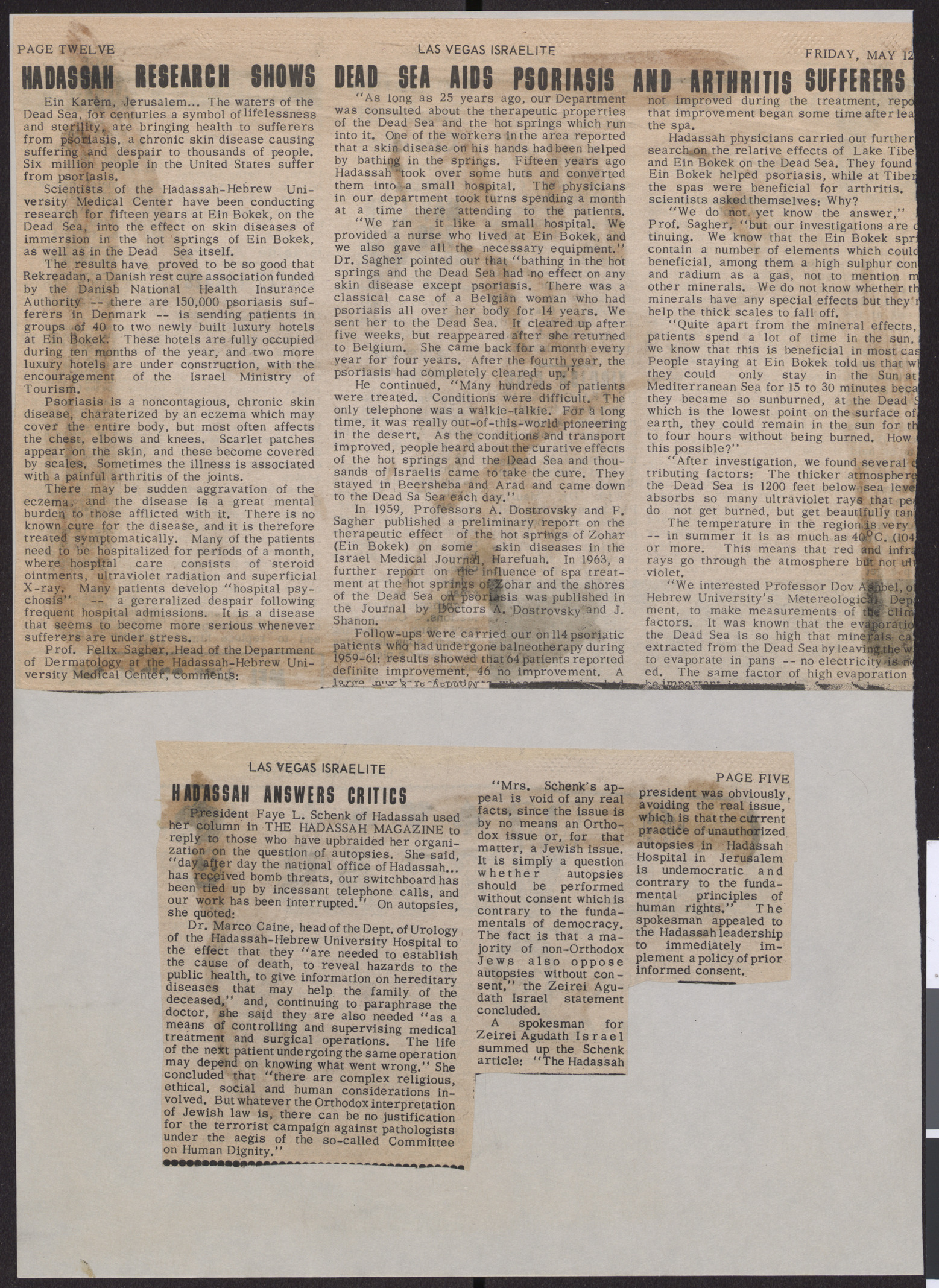 Newspaper clippings about Hadassah research on arthritis and autopsies, 1972